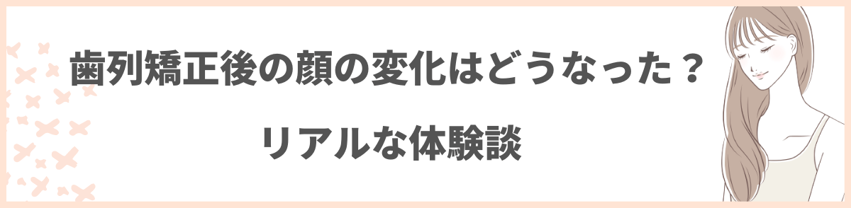 歯科矯正 ブサイク